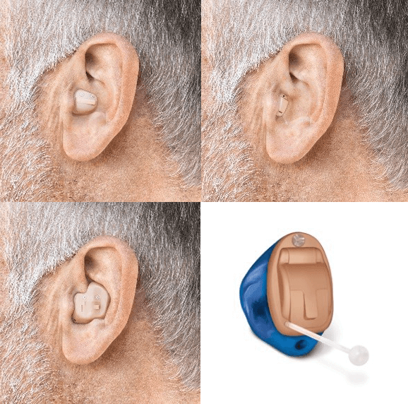 Разновидности слухового аппарата – внутриушной, внутриканальный и конха