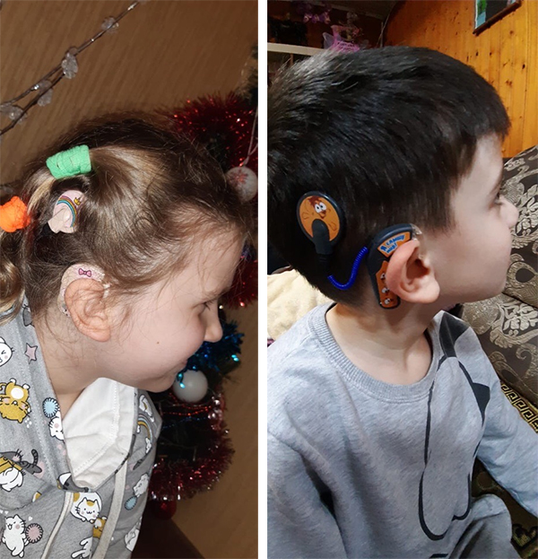 Слуховые аппараты на детях